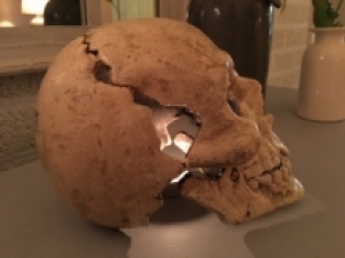 Grote Anatomische Schedel - Gietijzer - White-Rust